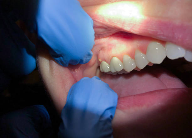 Best Pediatric Emergency Dentist in Pennington Gap, VA